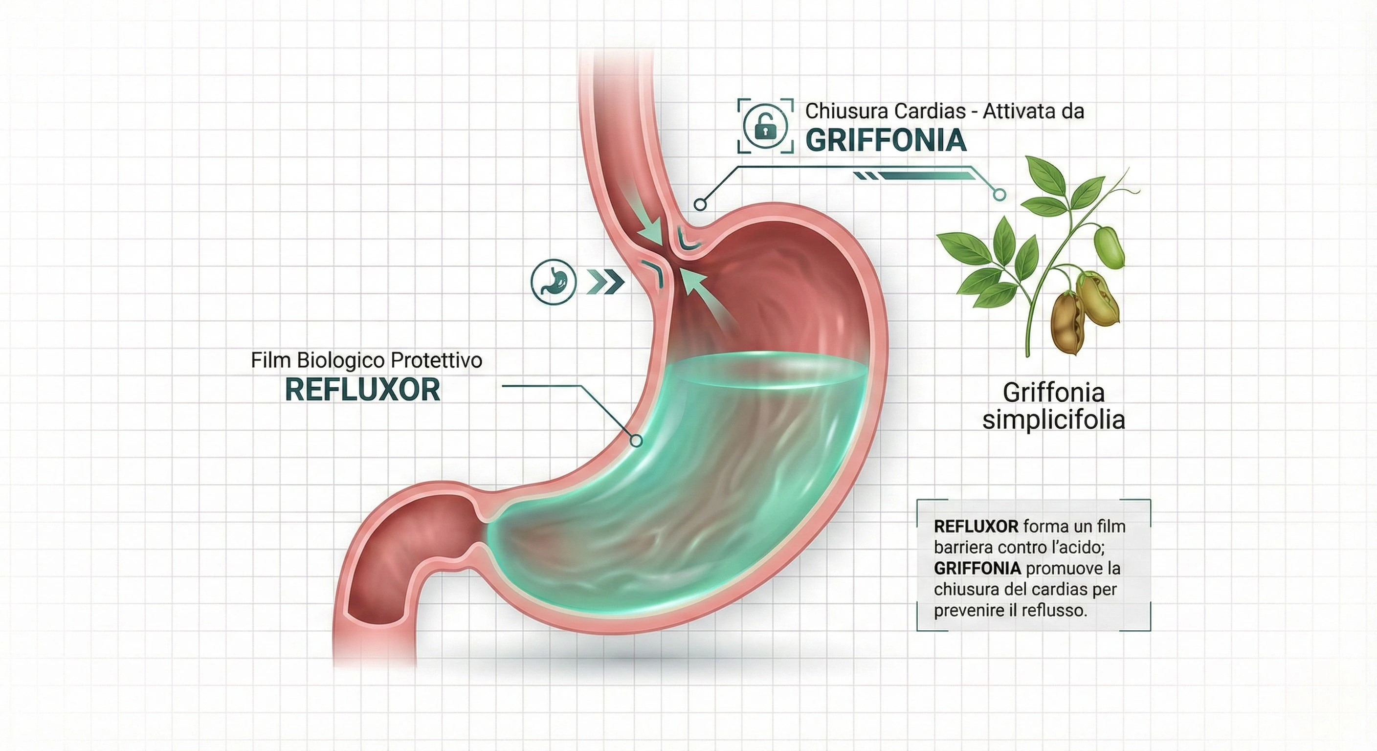 Illustrazione scientifica che mostra lo stomaco protetto dal film biologico di Refluxor e la valvola cardias che si chiude correttamente grazie alla Griffonia
