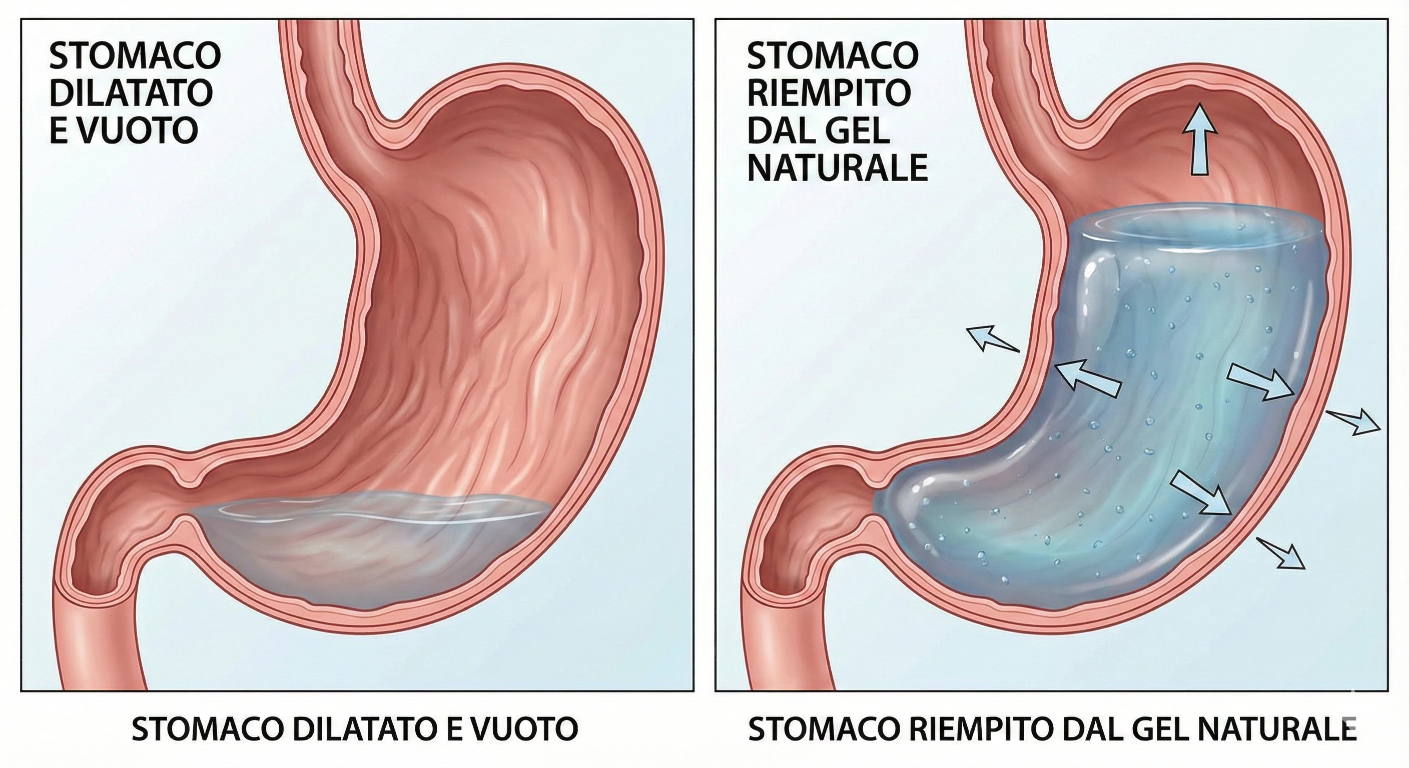 Illustrazione medica comparativa: a sinistra uno stomaco dilatato e vuoto, a destra uno stomaco riempito dal gel naturale che simula la sazietà meccanica
